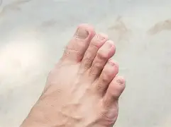 为什么说杨臭脚,为什么说杨臭脚臭呢