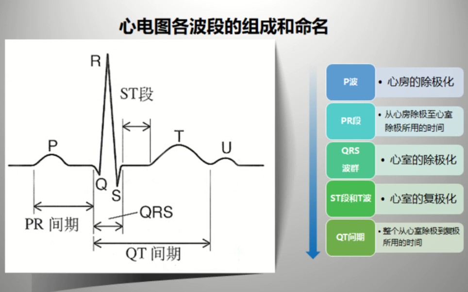 心电图图解,病理性q波心电图图解