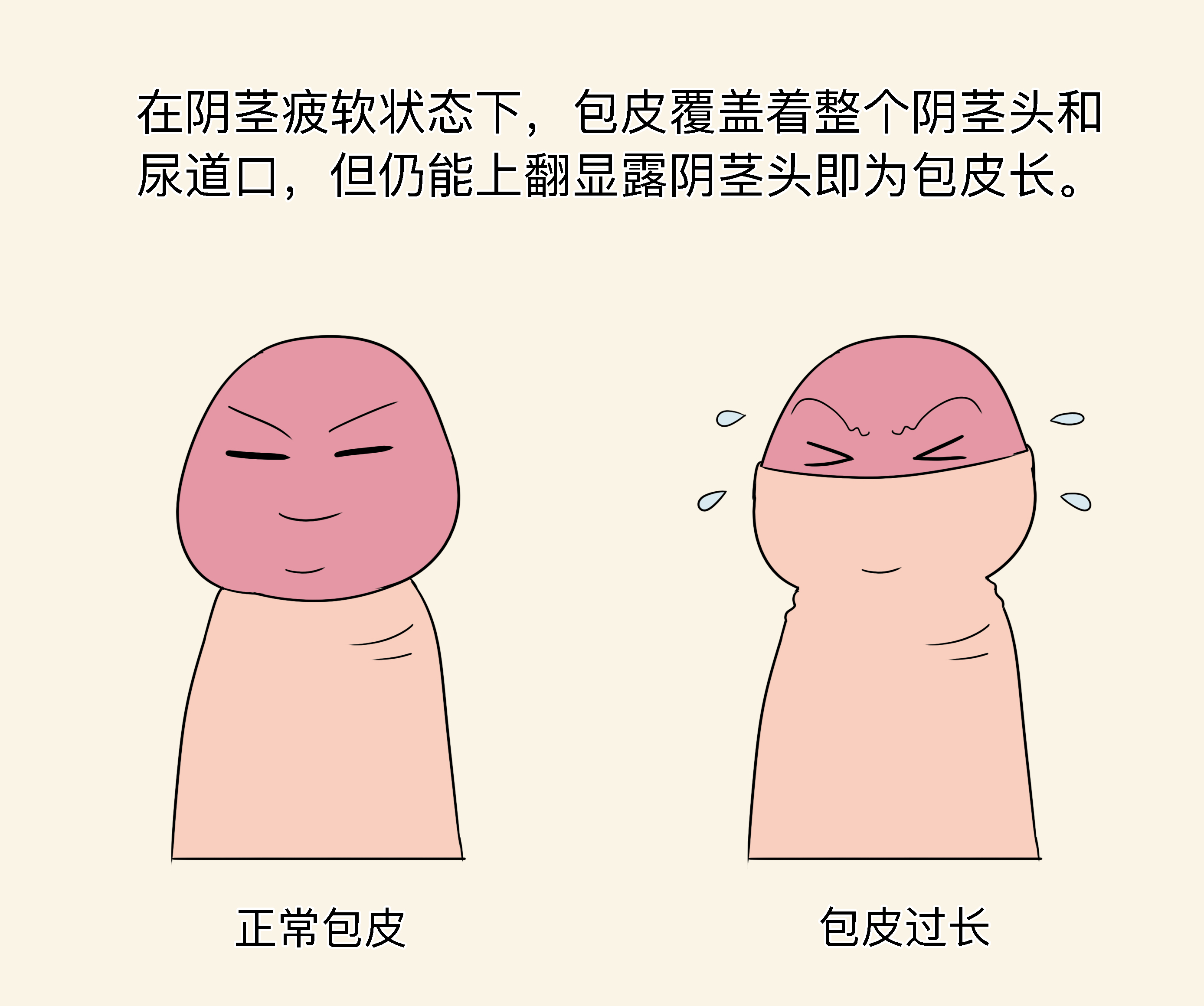 男孩包茎的症状图片,十三岁男孩包茎的症状图片