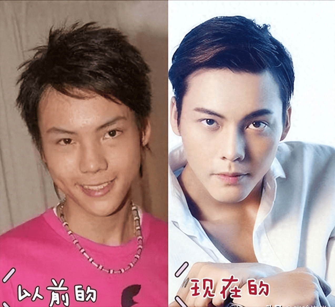 黄晓明整容前,杨颖谈黄晓明现状