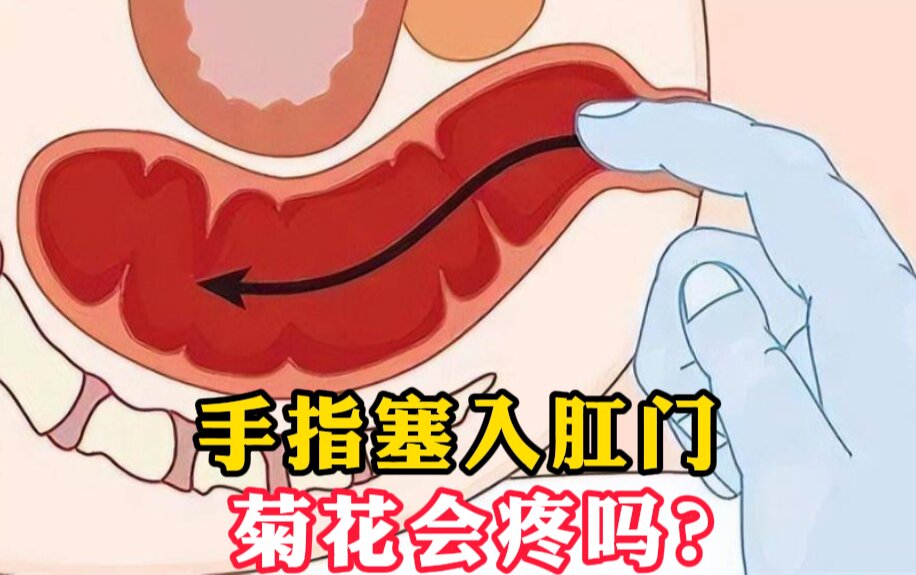 抠屁眼,三阳夹两阴多方炮战法