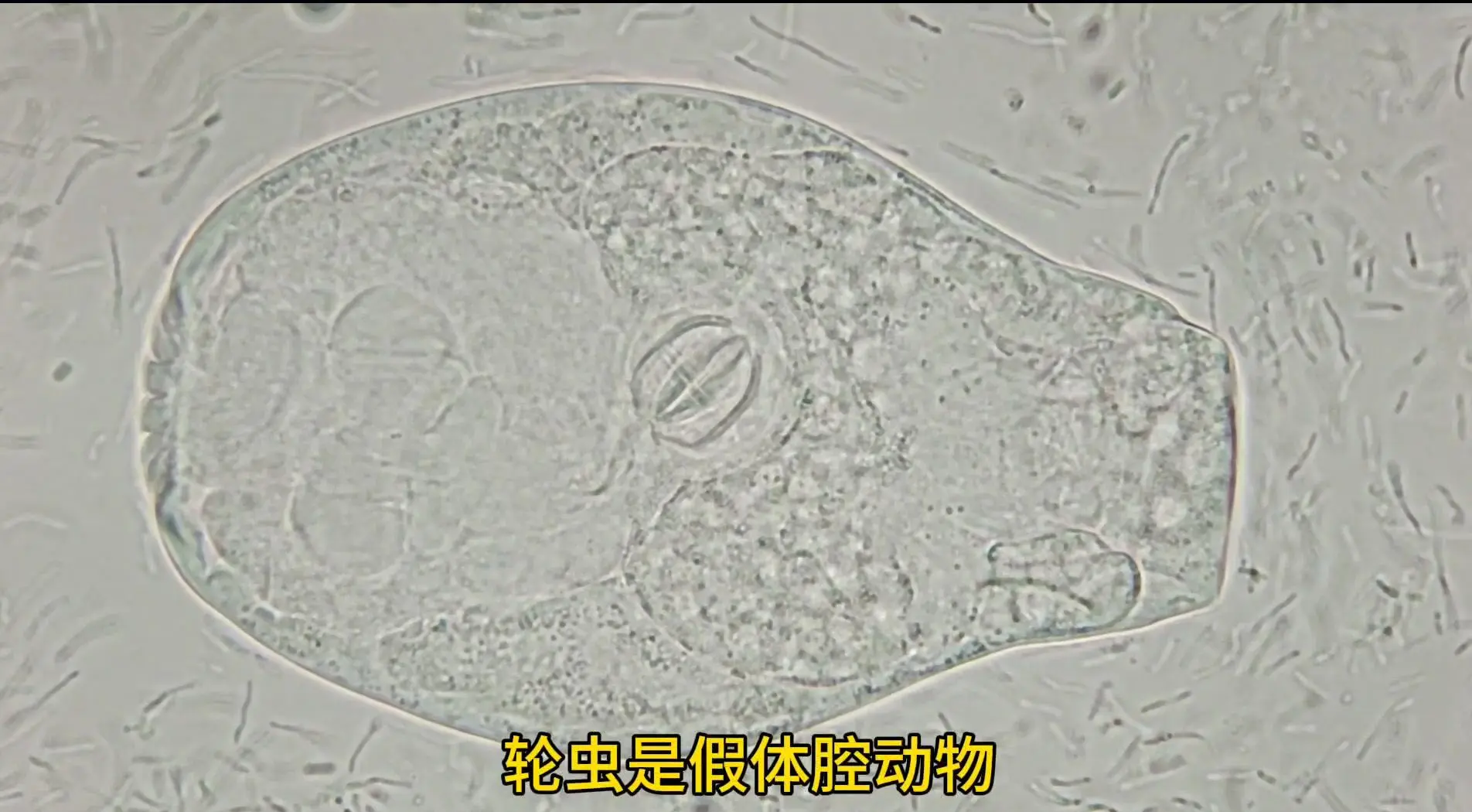 轮虫,轮虫对人体的危害